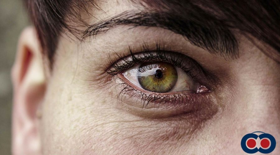 Il glaucoma: oltre 500.000 persone in Italia non sanno di averlo
